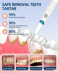 Ultrasonic Dental Scaler